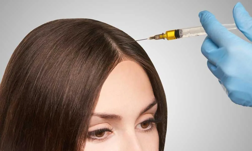 PRP for Scalp